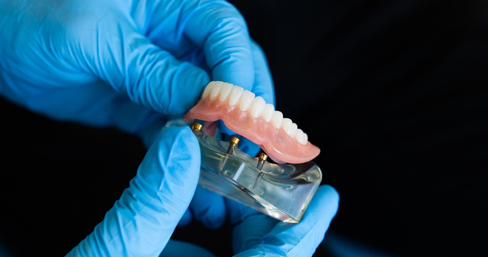 Zahnersatz | Nähere Informationen in einer Zahnarztpraxis in Buchholz